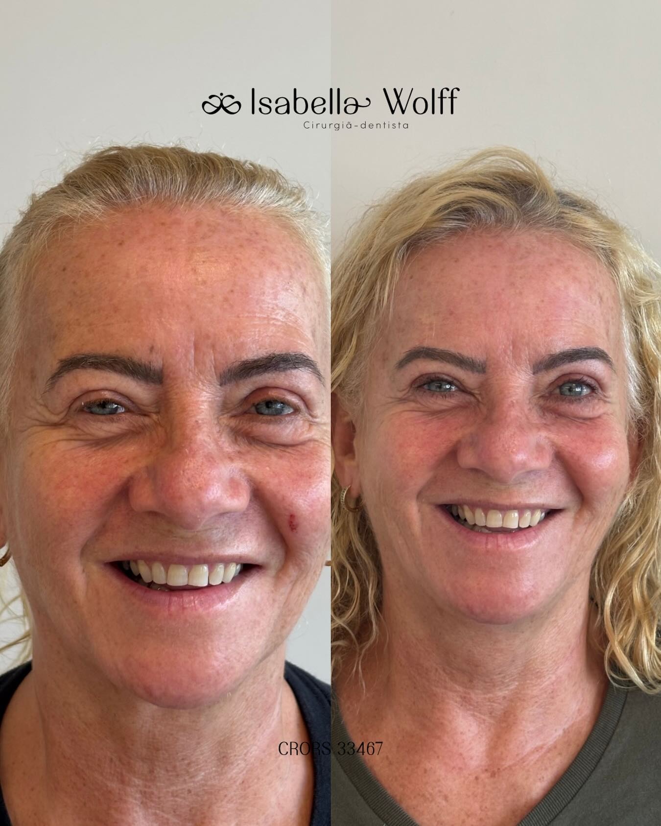 Reabilitação estética